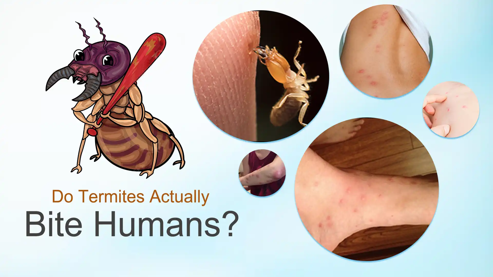 do termite bite humans